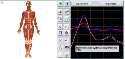 biorésonace étape 1